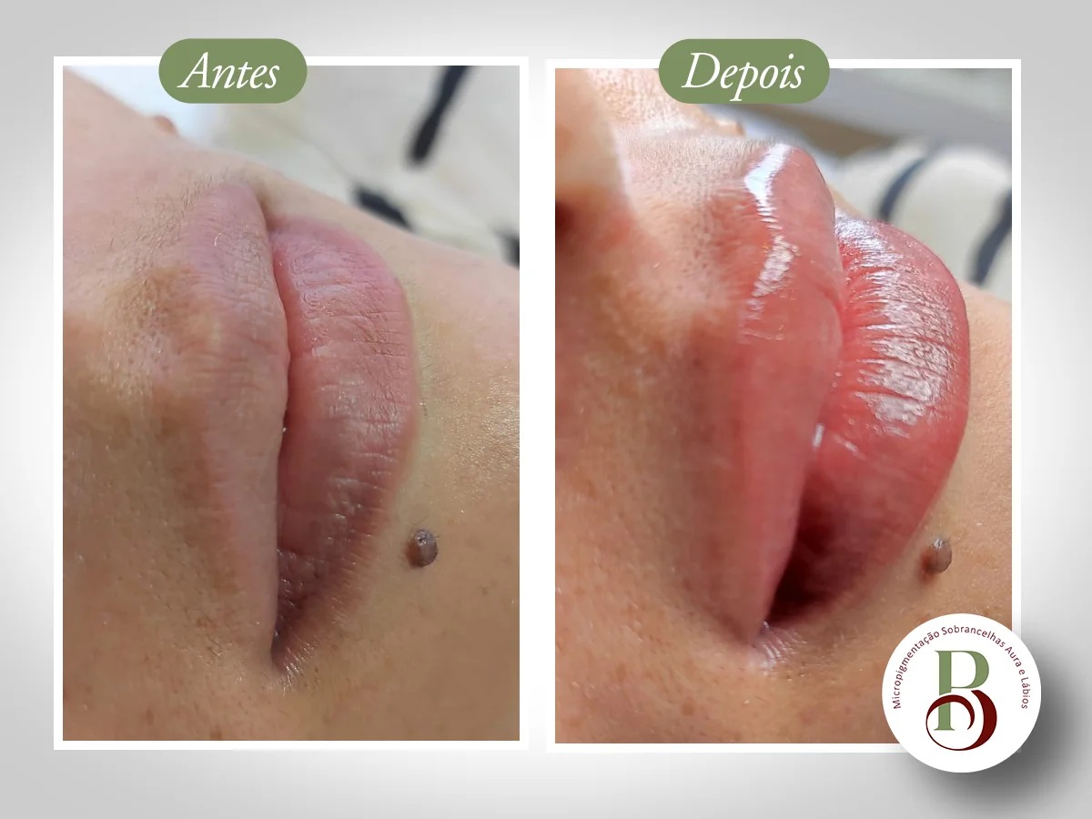 Micropigmentação Labial - Resultado Natural