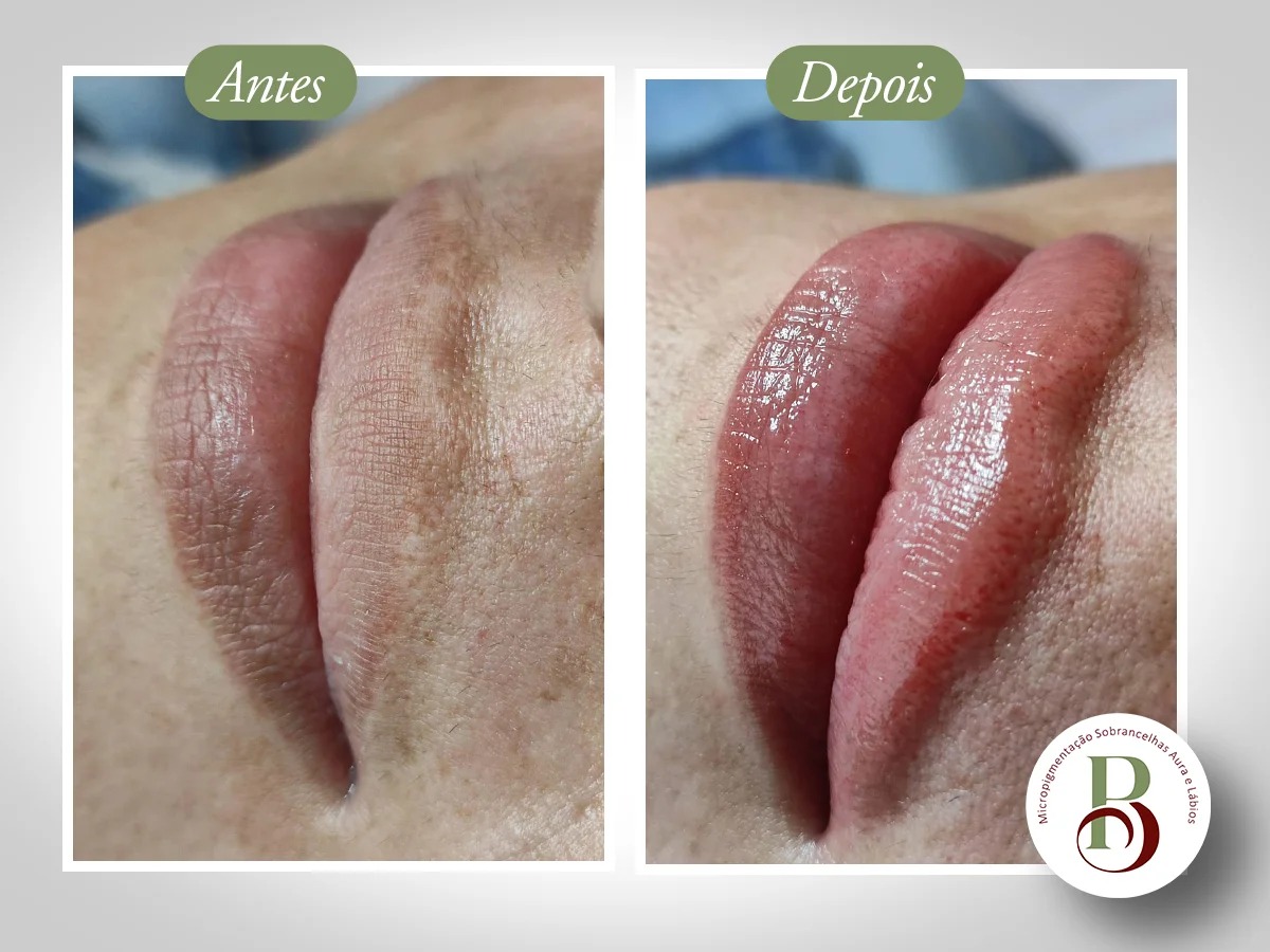 Lábios Volumosos e Definidos